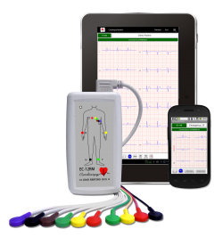 Telemetry ECG
